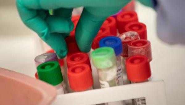imagen Doctorado en Biotecnología califica de “exitoso” proceso de admisión 2021